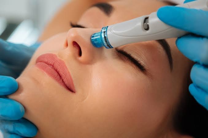 Physician performing a HydraFacial treatment on a patient