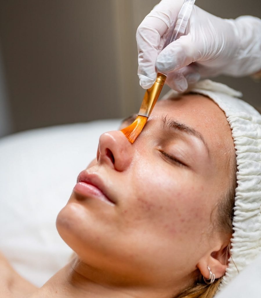 Physician applying a rejuvenating peel treatment to a patient's face